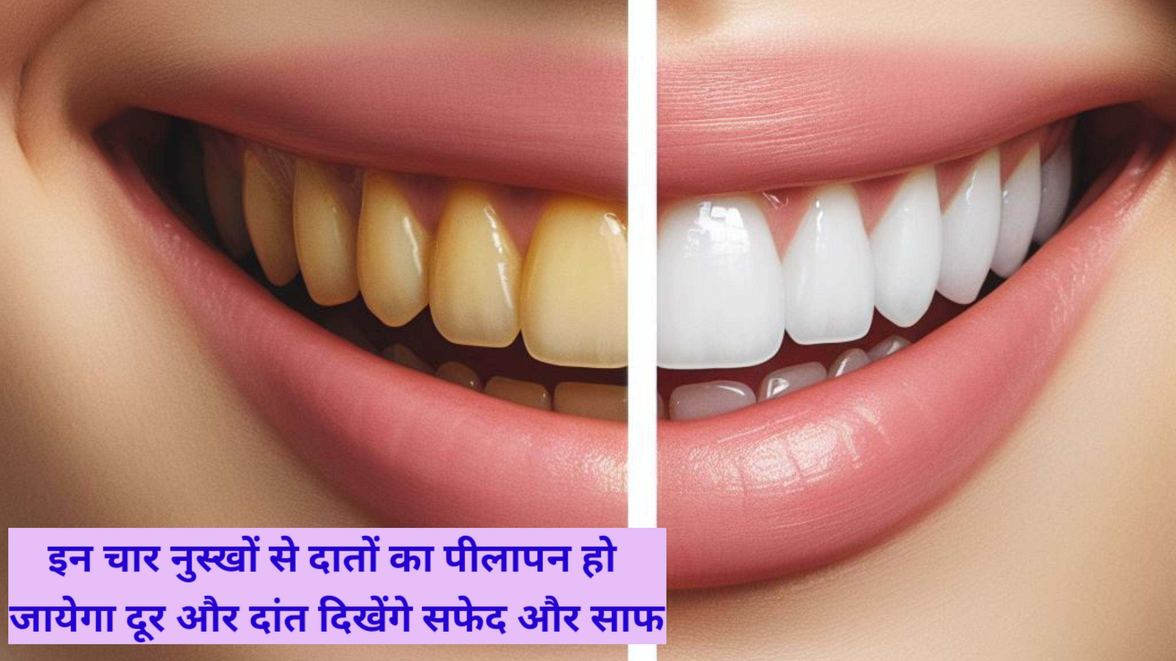 White Teeth Solution : दांतों की देखभाल : चार घरेलू उपाय सफेद और साफ दांतों के लिए